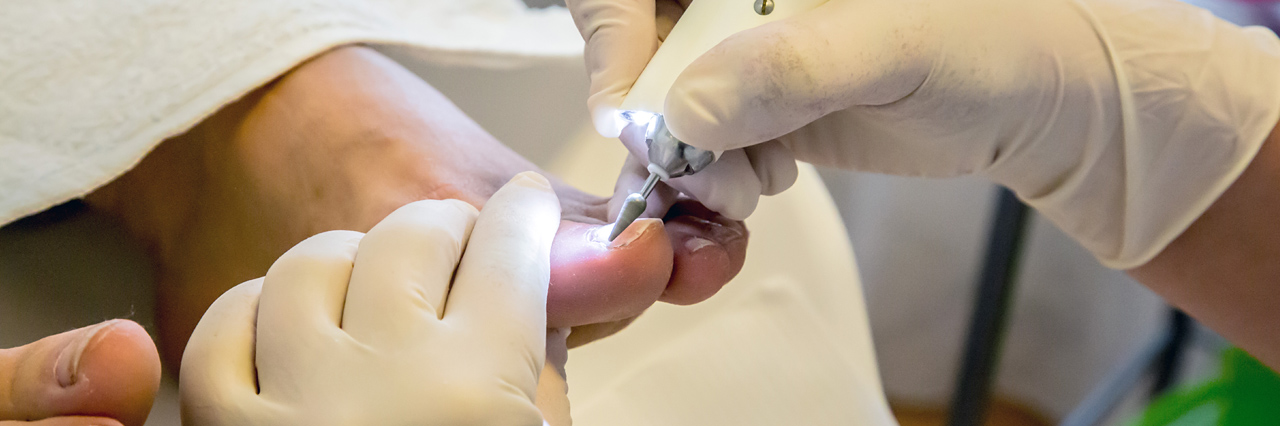 Pedique-Anique_IMG02